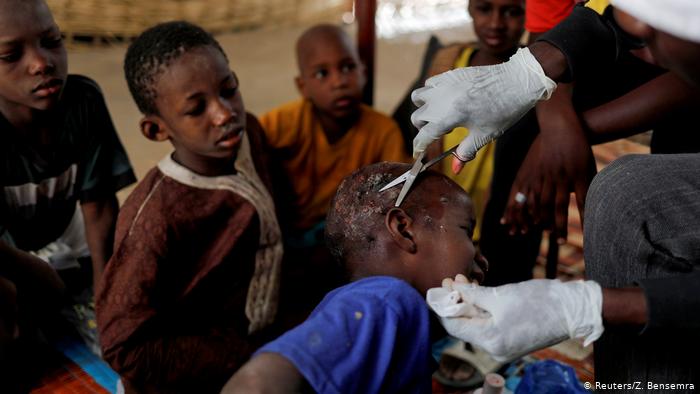 El Hadj Diallou, a former talibe, who became a medic at la Maison De la Gare, treats children with scabies at the daara (photo: Zohra Bensemra)