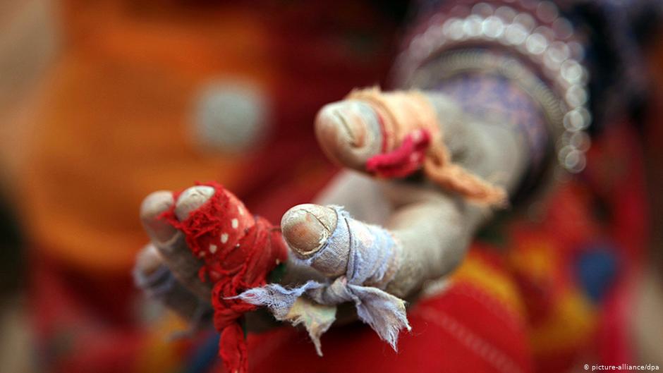 Sixty year-old Shyari's hands are bound in rags in an attempt to protect them against the bricks she has to shift for twelve hours a day (photo: picture-alliance/dpa)