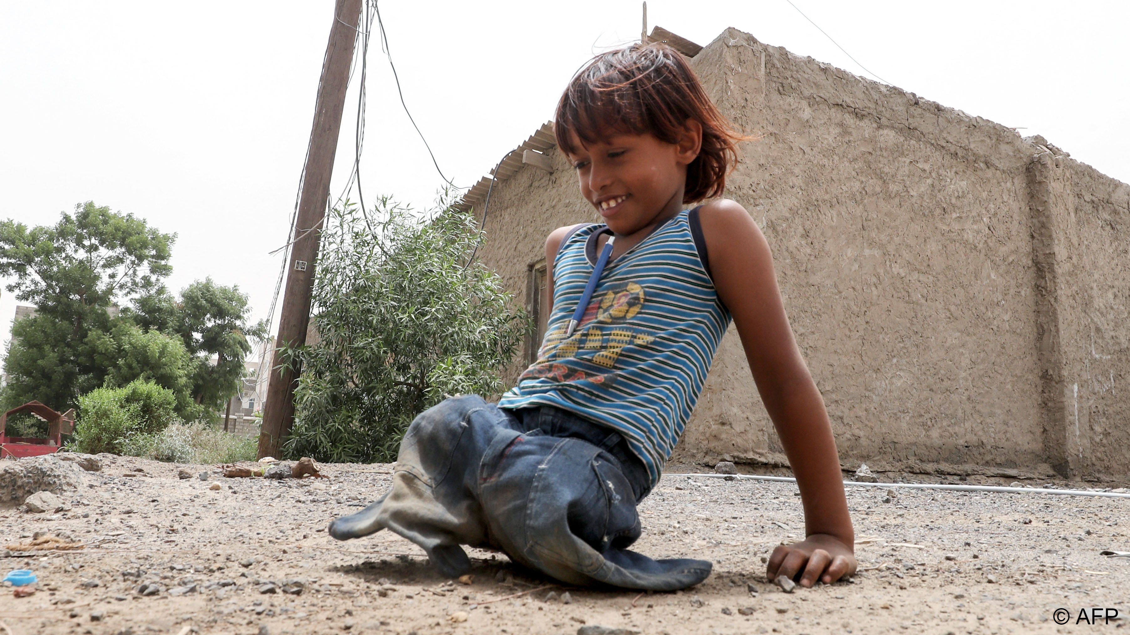 A Yemeni child whose legs were amputated after a landmine injury plays in the city of Aden on August 9, 2018 during a trip in Yemen organised by the UAE's National Media Council (photo: KARIM SAHIB AFP/File) 