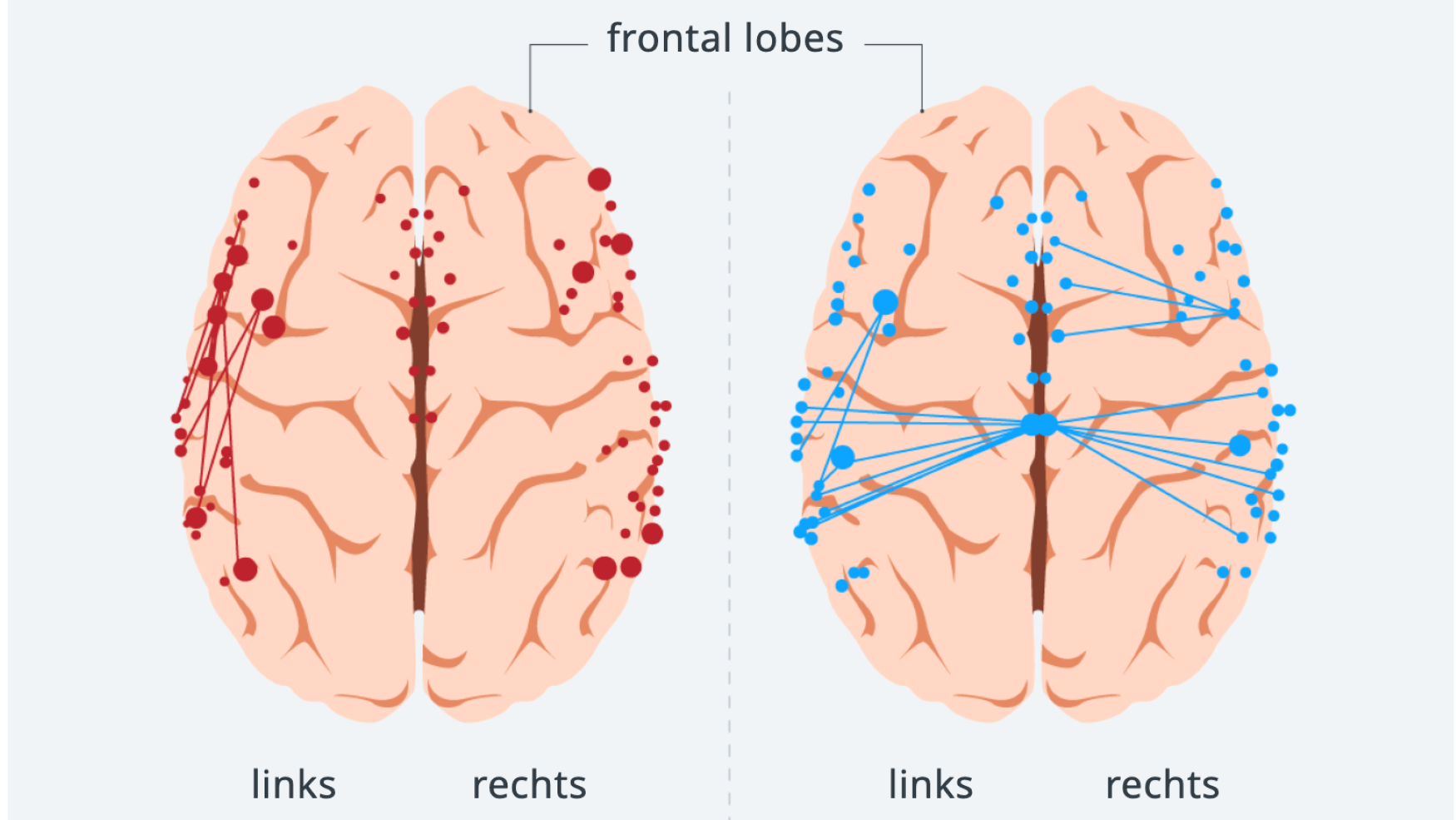 Language develops in different areas of the brain. Researchers have been able to show that the way these are linked varies according to the respective native language – knowledge that could prove useful in the treatment of stroke patients, for instance.