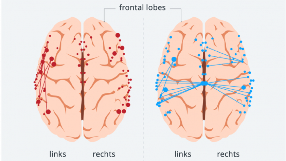 Sichtbar gemacht: die verschiedenen Sprachnetzwerke im Gehirn. 